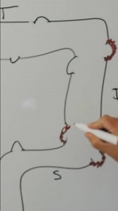 What is diverticulitis?