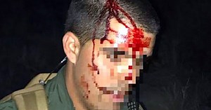 Bloodied border agent gives aid to illegal-alien attacker * WorldNetDaily * by Around the Web