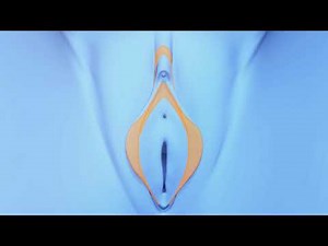 Labiaplasty Procedure explained video by Dr Mark Lowney