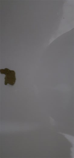 Korean girl diarrhea 6 - video 2