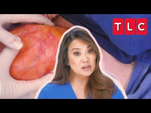 Most Extreme Pops From Season 7 PART 1 | Dr. Pimple Popper | TLC