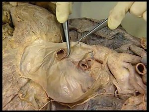 Dissection du corps humain, commentée : Viscères du thorax vue antérieure du thorax