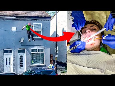 I fell off my roof...