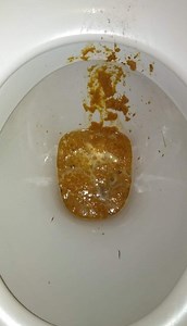 Farty diarrhea shit on Connors loo