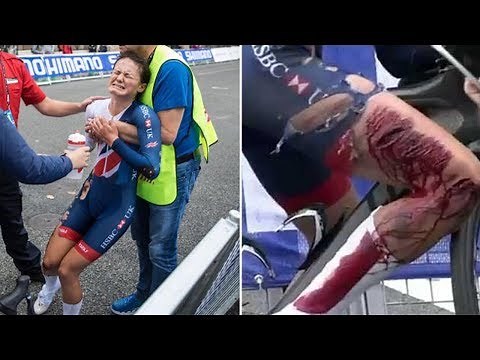 Cyclist Suffers NASTY Injury in Crash, Crosses Finish Line Anyway