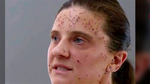 樂 ¿Fue discriminación?  Una mujer de California acusa a Southest Airlines de sacarla de un vuelo y supuestamente humillarla por su trastorno genético que ha modificado su rostro y su cuerpo con crecimiento de tumores. ¿Qué opinas tú? ♨️ La Mesa Caliente por Telemundo . | La Mesa Caliente | Facebook