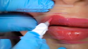 1K reactions · 31 shares | HL Laser Care on Reels | Facebook