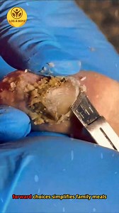 Ep.2 Nail health DASH diet weekly routine for women age 50 🎀🌺 #HeartStrong #HealthyLifestyle #Wellbeing | LOS A-T BOYZ