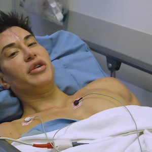 9.8K views · 48 reactions | What do you think? Human Ken Doll Justin Jedlica is the first person in the world to get implants in his back  for $20,000 | ChantiMan | Facebook