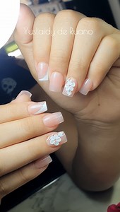 432K views · 13K reactions | Transformation into bitten nails. | Yuslaidy de Ruano | Facebook