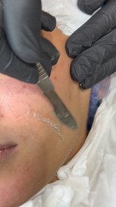 حتي ابسط جلسه عندنا بتصنع الفرق❤ | Mask & cream facial care center