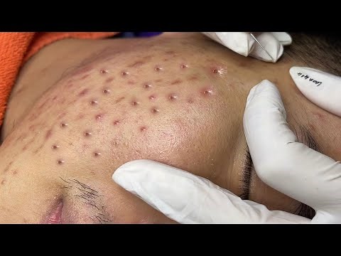 Satisfying With Loan Nguyen Spa Video #014