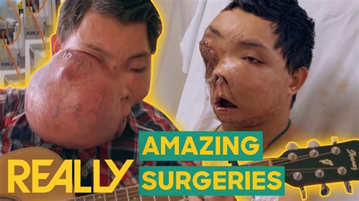Amazing life-changing surgeries and their impact on inspirational individuals dealing with rare conditions. Body Bizarre 3010 #pimple #popper #drpimplepopper #bodybizarre | Pimple Daily Post