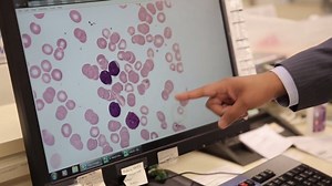 27K views · 364 reactions | Meet the #Pathologists Working Hard to...