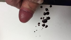 First ejaculation after prostate biopsies