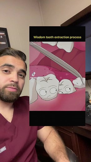 This is how we take out wisdom teeth! #wisdomteeth #wisdomteethremoval #teeth