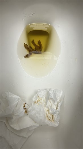 1/22/26 - IBS Flare Skinny Poop