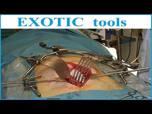 Omni Retractor System | Latest Video Omni Self Retaining Set | EXOTIC tools Premium Quality