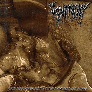 Hematology - Total Proctocolectomy With Ileal Pouch Anal Anastomosis