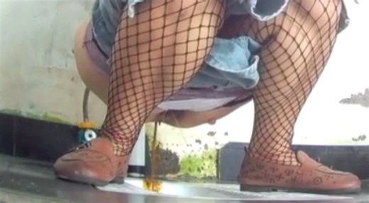 Serious diarrhea and loud fart