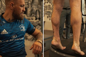 Conor McGregor steps up recovery from broken leg with pics of bulky calf muscles