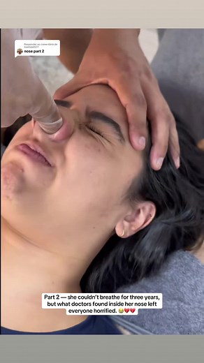 Respondendo a @trentsmith77 Part 2 nose #doctor #hospital #women #fyp #nose