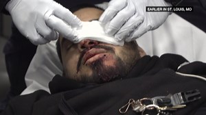 Watch as paramedics arrive on the scene of a man who has been knocked out. | Live Rescue on A&E