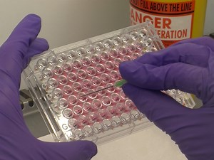 Three-Dimensional 3D Tumor Spheroid Invasion Assay