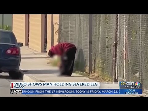Video appears to show man with severed body part in Wasco, man arrested