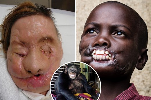 World’s most horrific chimp attacks as apes rip off people’s faces & genitals