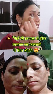 1.1K reactions · 24 shares | “Chehre ka kalapan gaya  Divya Aushadhi...
