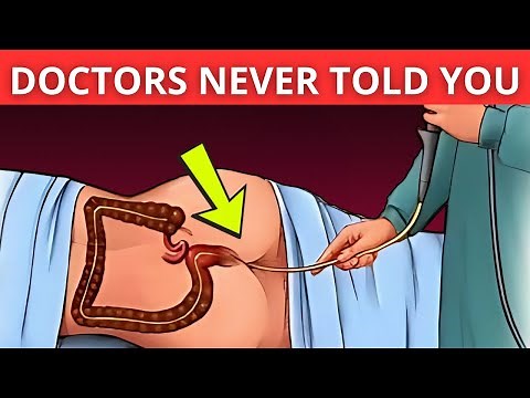 WARNING ⚠️What Doctors Never Told You About Colonoscopy!