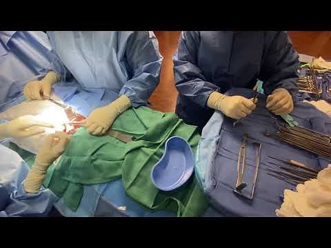 3/3 surgical technology bowel resection