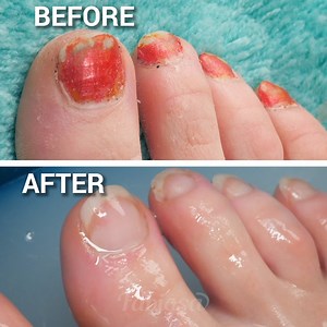 4.4K views · 12 reactions | Become a nail guru with these superb tips and tricks. | Tips & Tricks | Facebook