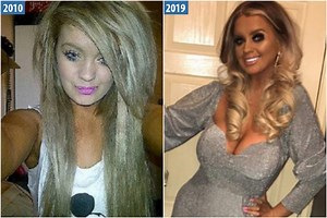 EuroMillions winner shows off 10-yr transformation thanking lotto for surgery