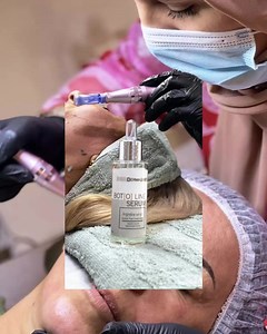 Kurs dermapen ☎️ 0607237853 ili 0112420337 Akreditovan kod Agencije...