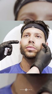 30 reactions | PATIENT STORY |  MALE FACIAL SCULPTING ⁣JAWLINE,...