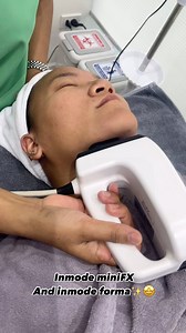 Inmode miniFX for fat removal and Inmode forma for stimulate collagen & lifting 🤩👒 ▫️▫️▫️▫️▫️▫️▫️▫️▫️▫️▫️▫️▫️ สนใจสอบถามข้อมูลเพิ่มเติมได้ที่ LINE ID : renewmeth Kakaotalk : renewmeskin WeChat : renewmeskin IG: @renewmeskin.th 📩: renewmethailand@gmail.com เปิดบริการทุกวัน 10.00 - 19.00 น. แผนที่ https://goo.gl/maps/jSXHAa2pcrXadHK49 มีที่จอดรถสะดวกสบายจาก Hyatt Regency Sukhumvit Hotel ▫️▫️▫️▫️▫️▫️▫️▫️▫️▫️▫️▫️▫️ • • • #facial #renewme #skinclinic #renewmeskinclinic #bangkokskinclinic #facialde