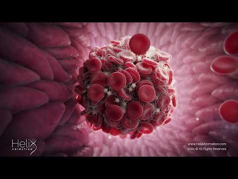 Blood clot Formation