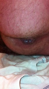 Poop on white underwear