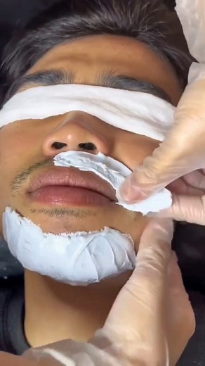 beard removal #waxaddict #waxingspecialist #reels | Wax 101