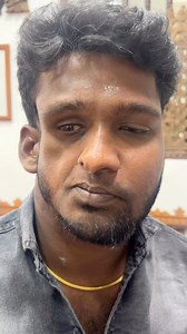 Classical Patient with Hem Facial Atrophy - Parry Rhomberg Syndrome #facialdeformity #asymmetry #plasticsurgery via @drsunilrichardson | Medical Story Nepal