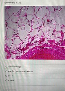 Identify the tissue hyaline cartilage stratified squamous epith... | Filo