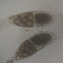 Video: Live Imaging of GFP-labeled Proteins in Drosophila Oocytes