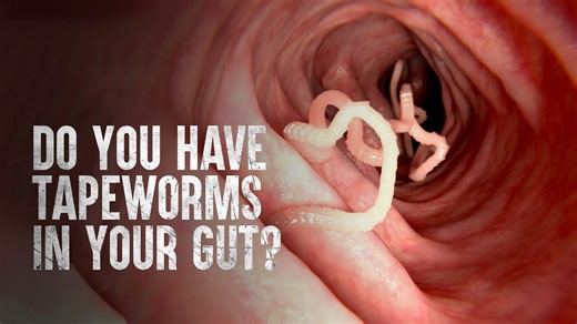 The Gross Truth About Tapeworms and How They Spread