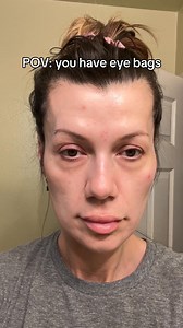 RevitalEyes by Botanique Paris uses red light therapy and EMS to visibly reduce eye bags and under eye puffiness. #skincare #redlighttherapy | Botanique Paris