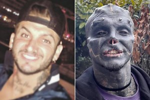 Man turns himself into ‘black alien’ by removing nose, top lip