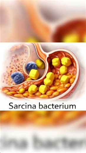 Coccus bacteria infection