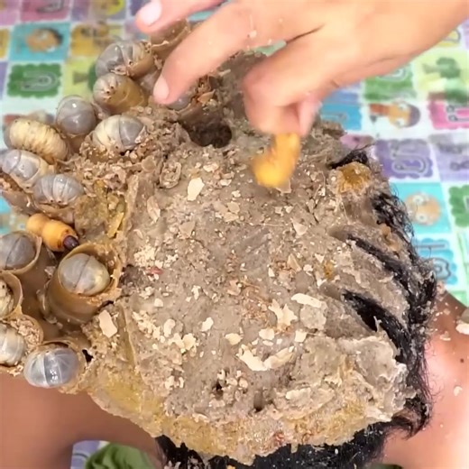 Dandruff Big Flakes Satisfying Removal Maggot Worms On Hole #1701 Part 7 | Help remove ticks