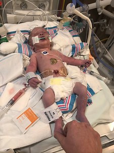 29K views · 442 reactions | Pitocin ruptured my uterus. I survived. Now I speak up. Women deserve to be told the risks. | Katie Spinks | Facebook